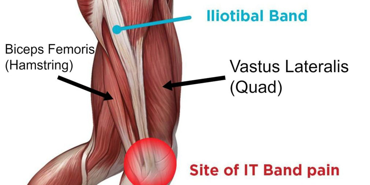 Pain under the knee? it might be the IT Band syndrome - feat